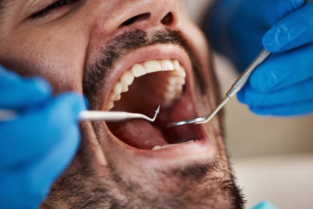 Best Emergency Gum Pain Relief  in Stockbridge, GA